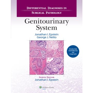 Differential Diagnoses in Surgical Pathology: Genitourinary System - Epstein Jonathan I.; Netto George J. - LIPPINCOTT Williams and Wilkins - 9781451189582