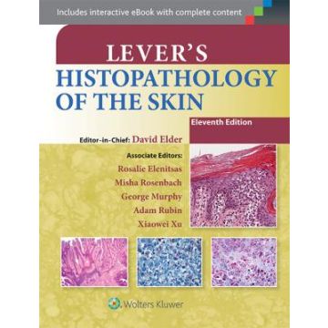 Lever's Histopathology of the Skin, 11ed. - Elder David E. - LIPPINCOTT Williams and Wilkins - 9781451190373