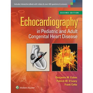 Echocardiography in Pediatric and Adult Congenital Heart Disease, 2ed. - Eidem Benjamin W.; O'Leary Patrick W.; Cetta Frank - LIPPINCOTT Williams and Wilkins - 9781451191226