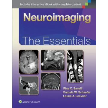 Neuroimaging: The Essentials  Sanelli Pina; Schaefer Pamela; Loevner Laurie  LIPPINCOTT Williams and Wilkins  9781451191356
