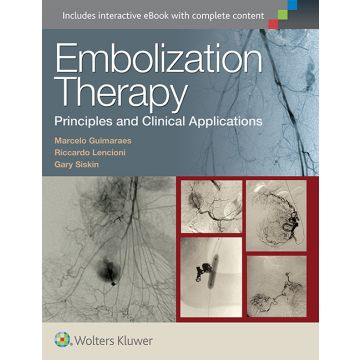 Embolization Therapy: Principles and Clinical Applications - Guimaraes Marcelo; Lencioni Riccardo; Siskin Gary - LIPPINCOTT Williams and Wilkins - 9781451191448