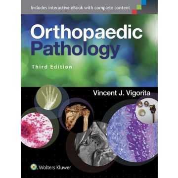 Orthopaedic Pathology, 3ed.  Vigorita Vincent J.  LIPPINCOTT Williams and Wilkins  9781451192025