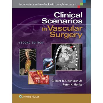 Clinical Scenarios in Vascular Surgery, 2ed.  Upchurch Gilbert R.; Henke Peter K.  LIPPINCOTT Williams and Wilkins  9781451192131