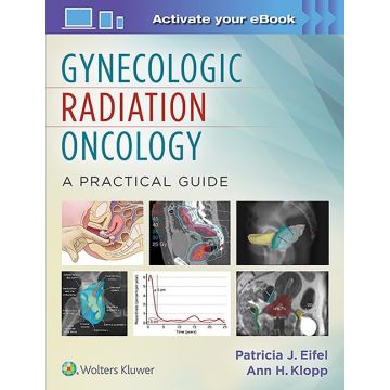 Gynecologic Radiation Oncology: A Practical Guide  Eifel Patricia; Klopp Ann H.  LIPPINCOTT Williams and Wilkins  9781451192650