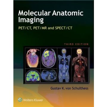 Molecular Anatomic Imaging, 3ed.  Von Schulthess Gustav K.  LIPPINCOTT Williams and Wilkins  9781451192667