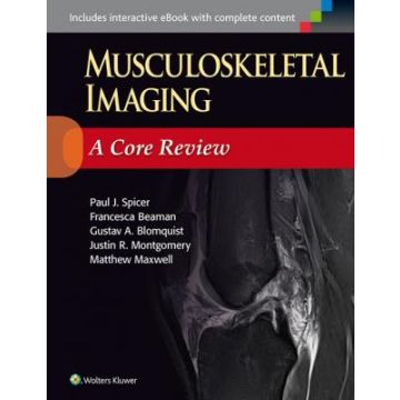 Musculoskeletal Imaging: A Core Review - Spicer Paul - LIPPINCOTT Williams and Wilkins - 9781451192674