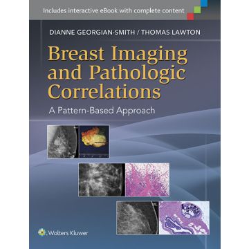 Breast Imaging and Pathologic Correlations. A Pattern-based Approach - Georgian-Smith Dianne - LIPPINCOTT Williams and Wilkins - 9781451192698