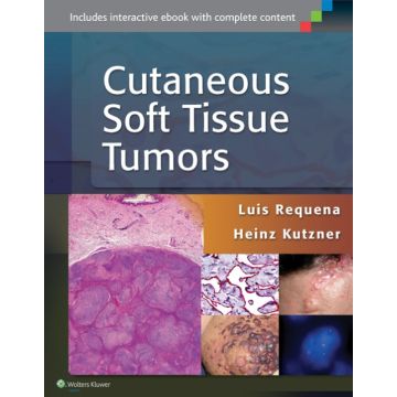 Cutaneous Soft Tissue Tumors - Requena Luis; Kutzner Heinz - LIPPINCOTT Williams and Wilkins - 9781451192766