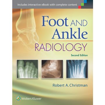 Foot and Ankle Radiology, 2ed. - Christman Robert - LIPPINCOTT Williams and Wilkins - 9781451192834
