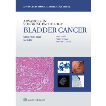 Advances in Surgical Pathology: Bladder Cancer  Zhai Qihui Jim; Ro Jae Y.  LIPPINCOTT Williams and Wilkins  9781451192889
