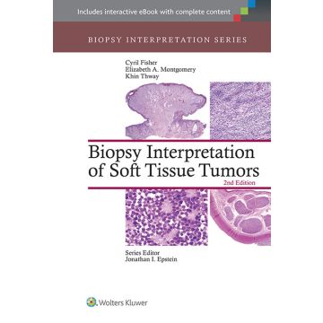 Biopsy Interpretation of Soft Tissue Tumors, 2ed.  Fisher Cyril; Montgomery Elizabeth; Thway Khin  LIPPINCOTT Williams and Wilkins  9781451192995