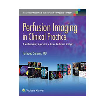 Perfusion Imaging in Clinical Practice  Saremi Farhood  LIPPINCOTT Williams and Wilkins  9781451193169