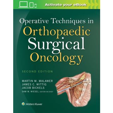 Operative Techniques in Orthopaedic Surgical Oncology, 2ed.  Malawer Martin M.; Bickels Jacob; Wittig James C.; Wiesel Sam W.  LIPPINCOTT Williams and Wilkins  9781451193275
