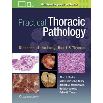 Practical Thoracic Pathology. Diseases of the Lung, Heart, and Thymus  Burke Allen P.; Aubry Marie-Christine; Maleszewski Joseph; Alexiev Borislav; Tavora Fabio  LIPPINCOTT Williams and Wilkins  9781451193510