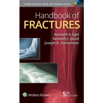 Handbook of Fractures, 5ed. - Egol Kenneth; Koval Kenneth J.; Zuckerman Joseph - LIPPINCOTT Williams and Wilkins - 9781451193626