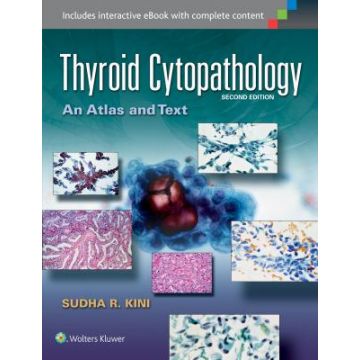 Thyroid Cytopathology, 2ed.  Kini Sudha R.  LIPPINCOTT Williams and Wilkins  9781451193893