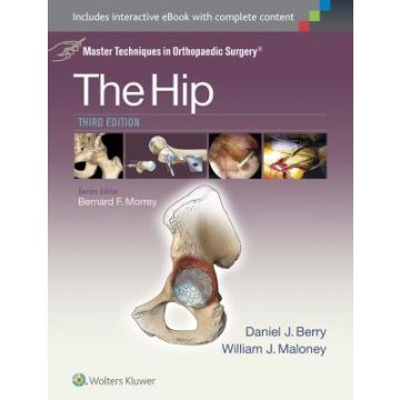 Master Techniques in Orthopaedic Surgery: The Hip, 3ed.  Berry Daniel J.; Maloney William  LIPPINCOTT Williams and Wilkins  9781451194029