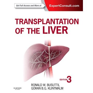 Transplantation of the Liver, 3rd Edition - Expert Consult - Online and Print    [Busuttil - Elsevier Science]