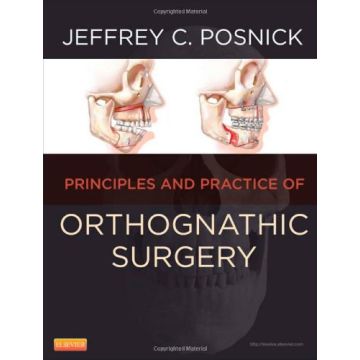 Orthognathic Surgery - 2 Volume Set - Principles and Practice