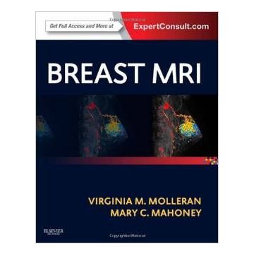 Breast MRI - Expert Consult: Online and Print