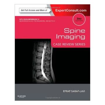 Spine Imaging, 3rd Edition - Case Review Series (Expert Consult - Online and Print)