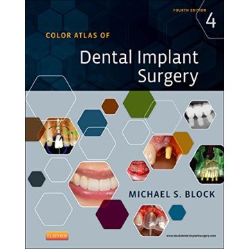 Color Atlas of Dental Implant Surgery, 4th Edition     [Block - Elsevier Science]