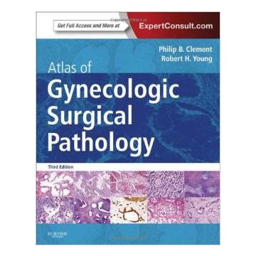 Atlas of Gynecologic Surgical Pathology, 3rd Edition - Expert Consult: Online and Print