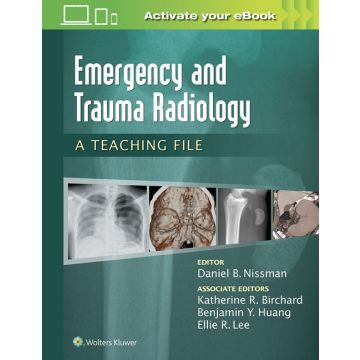 Emergency and Trauma Radiology: A Teaching File  Nissman Daniel B.  LIPPINCOTT Williams and Wilkins  9781469899480