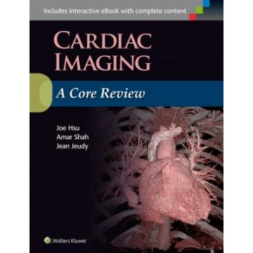 Cardiac Imaging: A Core Review  Hsu Joe; Shah Amar  LIPPINCOTT Williams and Wilkins  9781496300614