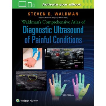 Waldman's Comprehensive Atlas of Diagnostic Ultrasound of Painful Conditions  Waldman Steven  LIPPINCOTT Williams and Wilkins  9781496302892
