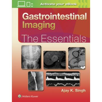 Gastrointestinal Imaging: The Essentials  Singh Ajay LIPPINCOTT Williams and Wilkins  9781496307194