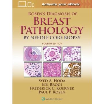 Rosen's Diagnosis of Breast Pathology by Needle Core Biopsy, 4/Ed.    [Hoda - LIPPINCOTT Williams and Wilkins]