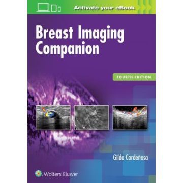 Breast Imaging Companion, 4/Ed.    [Cardenosa - LIPPINCOTT Williams and Wilkins]