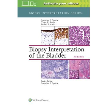 Biopsy Interpretation of the Bladder, 3/ed.  Epstein Jonathan; Reuter Victor; Amin Mahul B.  LIPPINCOTT Williams and Wilkins  9781496315045