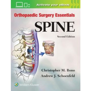 Orthopaedic Surgery Essentials: Spine, 2ed.  Bono Christopher M.; Schoenfeld Andrew J.  LIPPINCOTT Williams and Wilkins  9781496318541