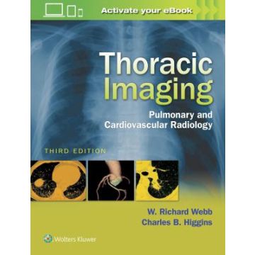 Thoracic Imaging, 3/Ed. - Pulmonary and Cardiovascular Radiology  [Webb - LIPPINCOTT Williams and Wilkins]