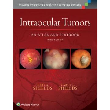 Intraocular Tumors: An Atlas and Textbook, 3ed. [Shields - LIPPINCOTT Williams and Wilkins]
