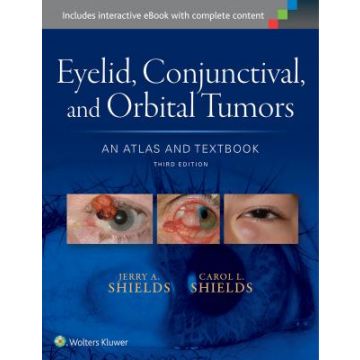 Eyelid, Conjunctival, and Orbital Tumors: An Atlas and Textbook, 3ed.  Shields Jerry A.; Shields Carol L.  LIPPINCOTT Williams and Wilkins  9781496321480