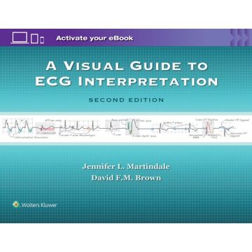 A Visual Guide to ECG Interpretation, 2ed.  Martindale Jennifer L.; Brown David F.M.  LIPPINCOTT Williams and Wilkins  9781496321534