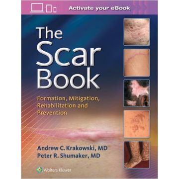 The Scar Book - FORMATION, MITIGATION, REHABILITATION AND PREVENTION   [Krakowski - LIPPINCOTT Williams and Wilkins]