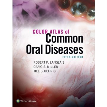Color Atlas of Common Oral Diseases, 5ed.  Langlais Robert;  Miller Craig  LIPPINCOTT Williams and Wilkins  9781496332080