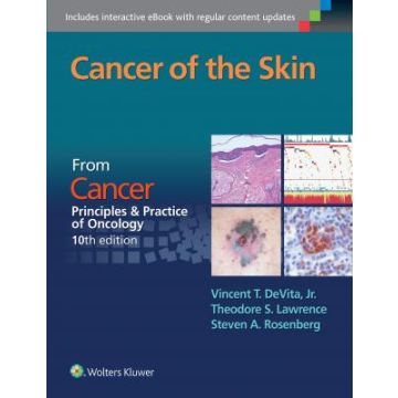 Cancer of the Skin. From Cancer: Principles & Practice of Oncology, 10ed.  DeVita Vincent T.; Lawrence Theodore S.; Rosenberg Steven A.  LIPPINCOTT Williams and Wilkins  9781496333933