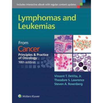 Lymphomas and Leukemias. From Cancer: Principles & Practice of Oncology, 10ed.  DeVita Vincent T.; Lawrence Theodore S.; Rosenberg Steven A.  LIPPINCOTT Williams and Wilkins  9781496333940