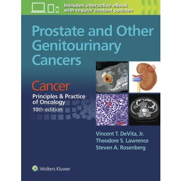Prostate and Other Genitourinary Cancers. From Cancer: Principles & Practice of Oncology, 10ed.  DeVita Vincent T.; Lawrence Theodore S.; Rosenberg Steven A.  LIPPINCOTT Williams and Wilkins  9781496333971