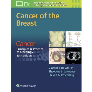 Cancer of the Breast. From Cancer: Principles & Practice of Oncology, 10/ed.  DeVita Vincent T.; Lawrence Theodore S.; Rosenberg Steven A.  LIPPINCOTT Williams and Wilkins  9781496333988