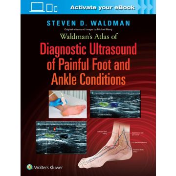 Waldman's Atlas of Diagnostic Ultrasound of Painful Foot and Ankle Conditions  Waldman Steven  LIPPINCOTT Williams and Wilkins  9781496345462