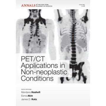 PET CT Applications in Non-Neoplastic Conditions  Hashefi Mandana; Akin Esma; Katz James D.  Wiley - Blackwell  9781573318181