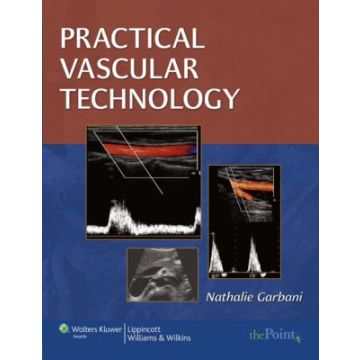 Practical Vascular Technology  Garbani Nathalie  LIPPINCOTT Williams and Wilkins  9781582558097