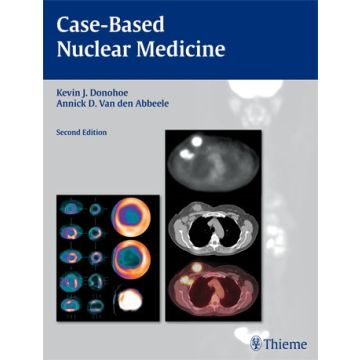 Case-Based Nuclear Medicine, 2/ed.  Donohoe Kevin J.; Van den Abbeele Annick D.  Thieme Medical Publishers  9781588906526