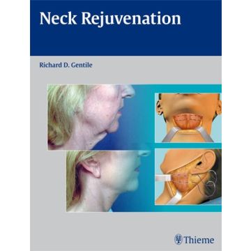 Neck Rejuvenation  Gentile Richard D. Thieme Medical Publishers  9781604060560